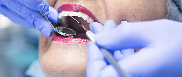 Best Urgent Tooth Repair  in Salida, CO